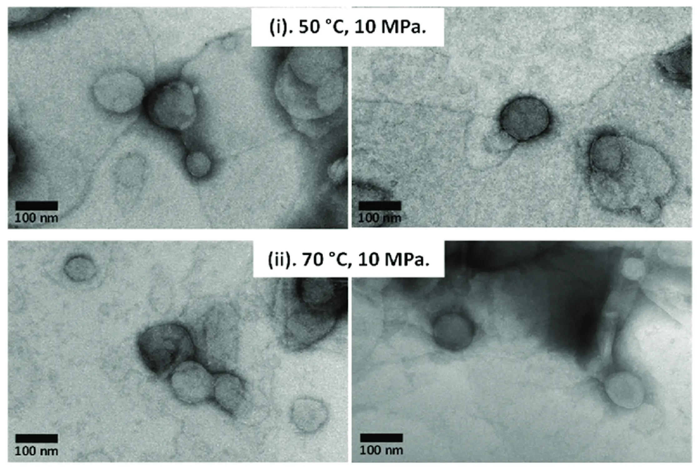 Microscopic view of liposomal curcumin particles showing spherical vesicle formation.